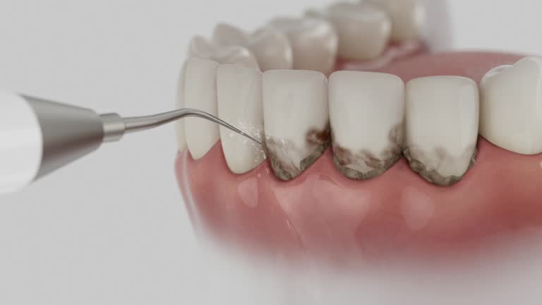 Trusted Teeth Whitening service in Marcellus, MI - Dentist Open Now